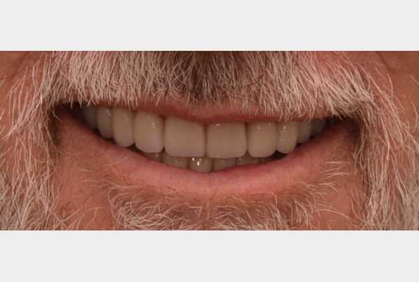 After treatment .jpg