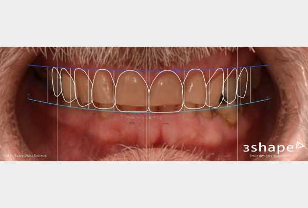 Digital Smile Design (DSD).jpg