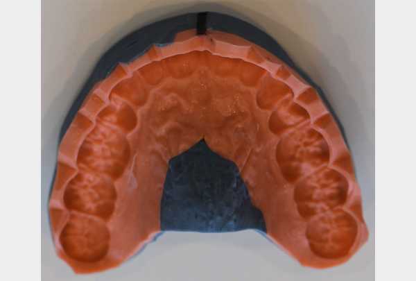 Silicone transfer.jpg